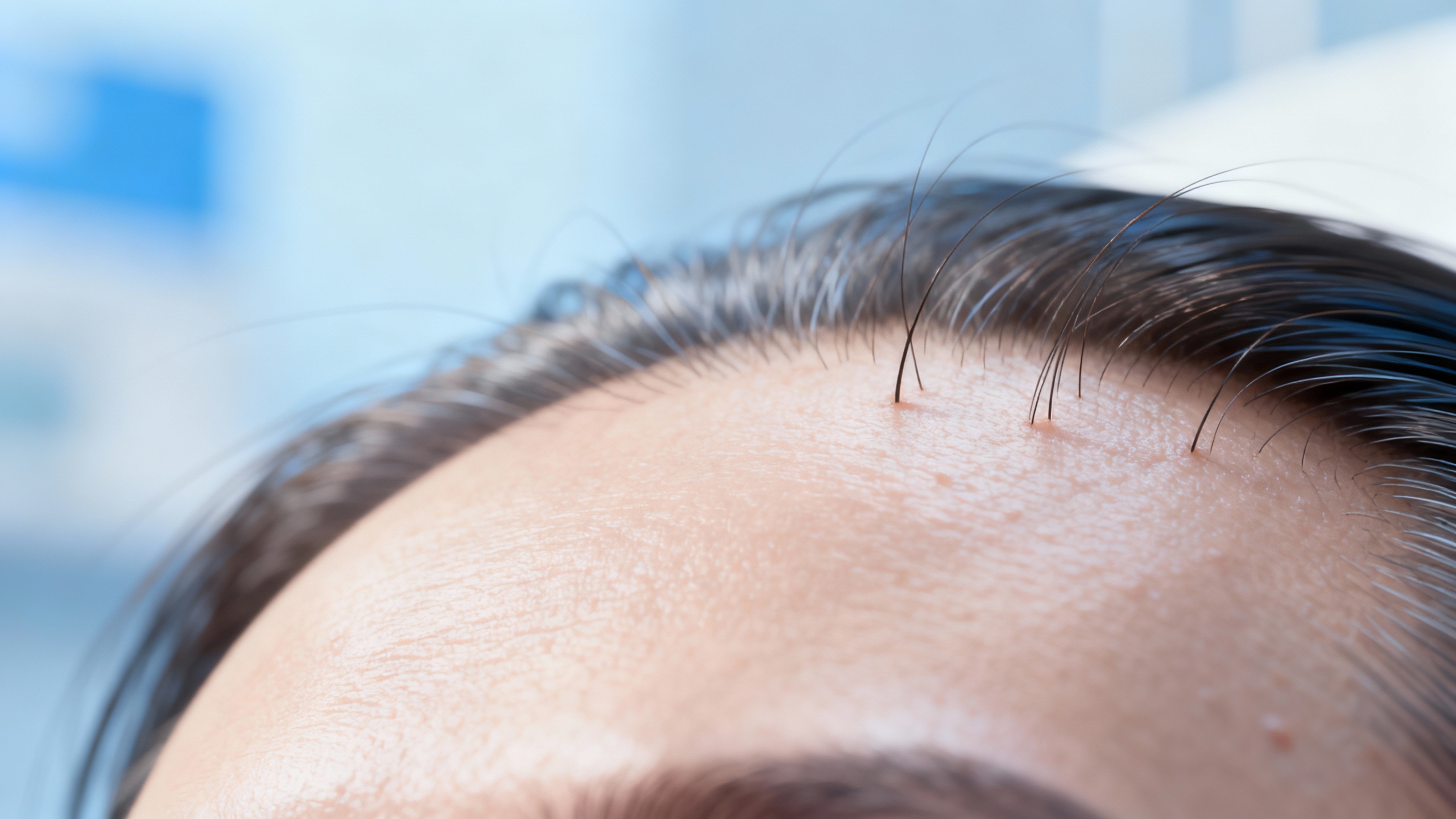 Featured image for Conquer the Battle: Achieving Seborrheic Dermatitis Symptom Reduction